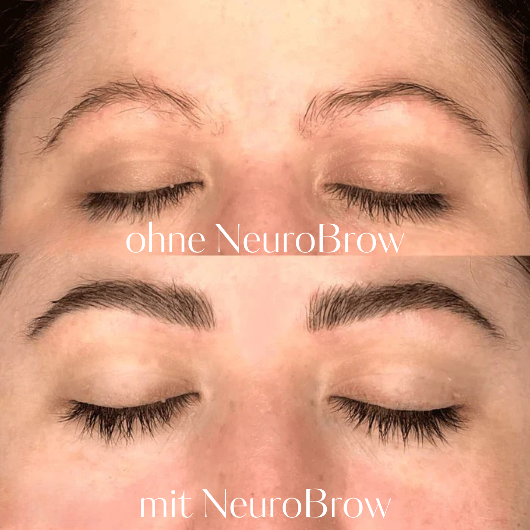 NeuroBrow